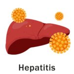 Hepatitis Treatment in Indore